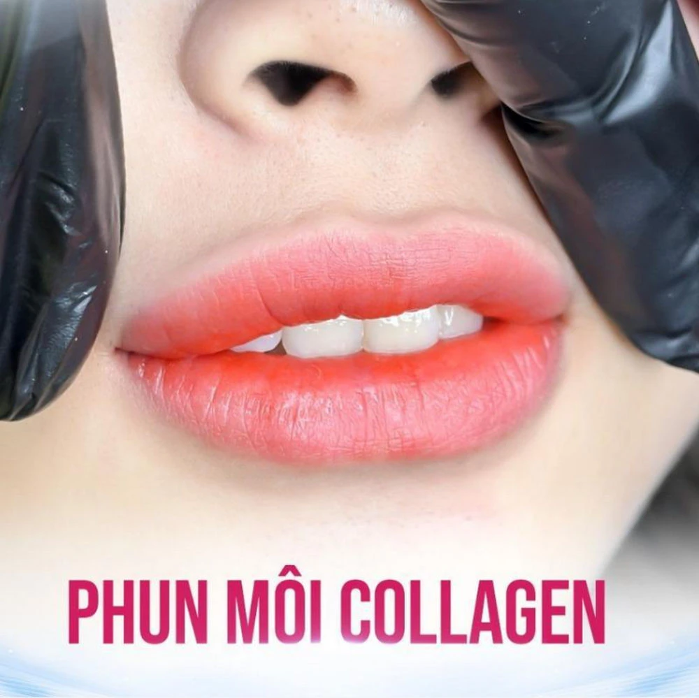 Phun môi nano collagen là kỹ thuật thẩm mỹ kết hợp hạt mực nano siêu nhỏ và tinh chất collagen