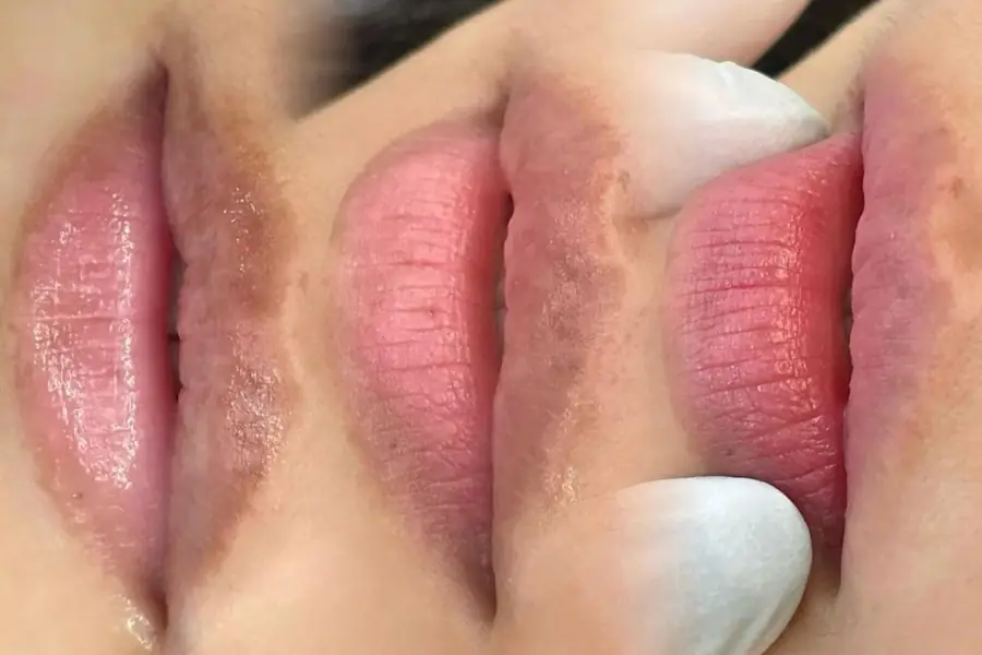 Những hiểu lầm nào phổ biến về kiêng ăn khử thâm?
