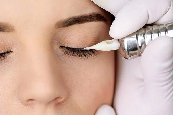Phun mí mở tròng là kỹ thuật gì?