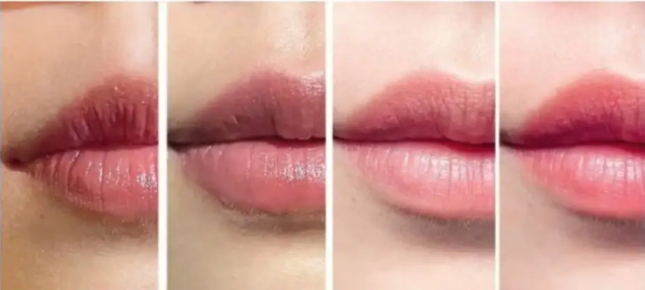 Vì sao môi bị thâm sau khi phun xăm?